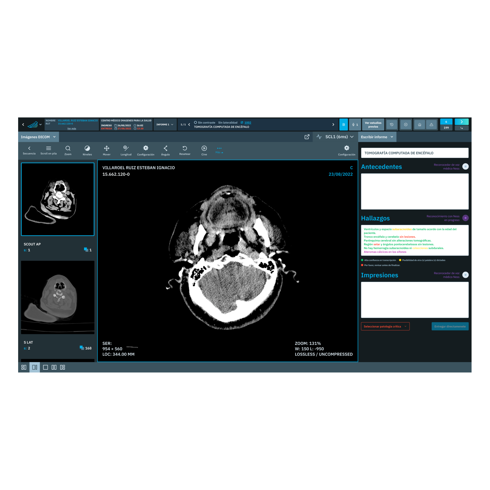 Prioritized and estimated work list using artificial intelligence.